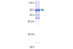 Image no. 1 for Glycerol Kinase (GK) (AA 1-524) protein (GST tag) (ABIN1355156) (Glycerol Kinase Protein (GK) (AA 1-524) (GST tag))