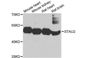 Western blot analysis of extracts of various cell lines, using STAU2 antibody. (Double-stranded RNA-binding protein Staufen homolog 2 (STAU2) (AA 300-400) antibody)