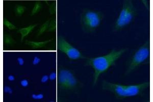 IF/ICC staining of human HeLa cells with Alexa Fluor 488 secondary, and GAPDH antibody at 5ug/ml (blue = DAPI nuclear counterstain). (GAPDH antibody)
