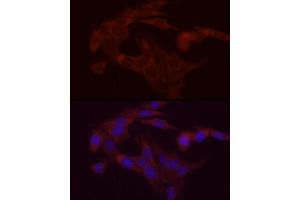 Immunofluorescence analysis of PC-12 cells using DG Rabbit pAb (ABIN6134325, ABIN6139556, ABIN6139557 and ABIN6222582) at dilution of 1:200 (40x lens). (DGAT1 antibody  (AA 200-300))