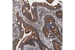 Immunohistochemical staining of human duodenum with CTTNBP2NL polyclonal antibody  shows strong cytoplasmic positivity in glandular cells. (CTTNBP2NL antibody)