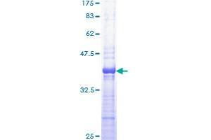 PRKAR1A Protein (AA 1-100) (GST tag)