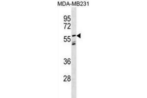 Western Blotting (WB) image for anti-Leucine-Rich Repeat LGI Family, Member 3 (LGI3) antibody (ABIN3000958)