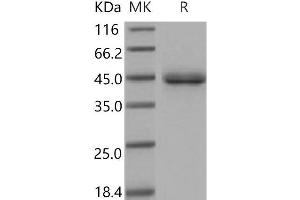 Western Blotting (WB) image for Surfactant Protein D (SFTPD) protein (His tag) (ABIN7320367) (SFTPD Protein (His tag))