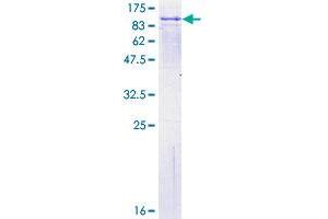 FPGT Protein (AA 1-594) (GST tag)