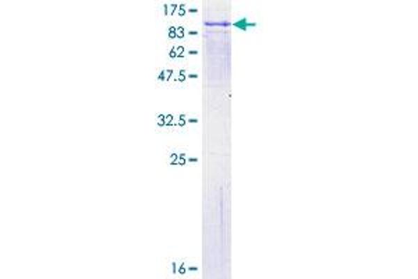 FPGT Protein (AA 1-594) (GST tag)