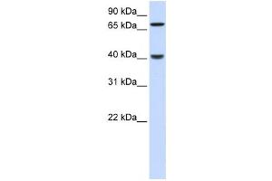 Western Blotting (WB) image for anti-PDZ and LIM Domain 3 (PDLIM3) antibody (ABIN2459845) (PDLIM3 antibody)