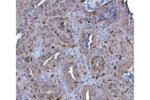 IHC analysis of MCM4 using anti-MCM4 antibody (ABIN7601485).