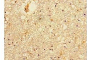 Immunohistochemistry of paraffin-embedded human brain tissue using ABIN7165067 at dilution of 1:100 (PRMT3 antibody  (AA 311-529))