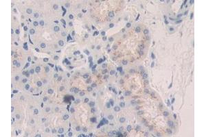 Used in DAB staining on fromalin fixed paraffin- embedded kidney tissue (CTSA antibody  (AA 215-470))