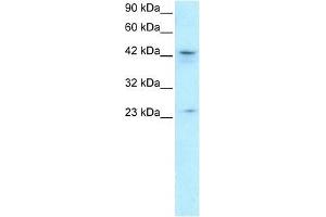 ZNF365 antibody used at 1. (ZNF365 antibody  (N-Term))
