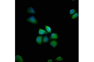 PDE8B antibody  (AA 18-110)