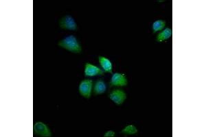 Immunofluorescence staining of Hela cells with ABIN7155168 at 1:66, counter-stained with DAPI. (PDE8B antibody  (AA 18-110))