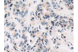 Immunohistochemistry (IHC) image for anti-Coagulation Factor II (Thrombin) Receptor-Like 3 (F2RL3) (AA 48-385) antibody (ABIN7431131)