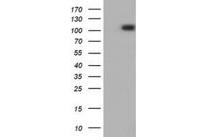 HEK293T cells were transfected with the pCMV6-ENTRY control (Left lane) or pCMV6-ENTRY PRKD2 (Right lane) cDNA for 48 hrs and lysed. (PKD2 antibody)