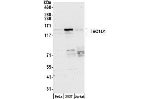 Western Blotting (WB) image for anti-TBC1 (Tre-2/USP6, BUB2, Cdc16) Domain Family, Member 1 (TBC1D1) (AA 1118-1168) antibody (ABIN7451033)