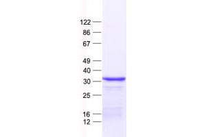Validation with Western Blot (PHYHD1 Protein (His tag))