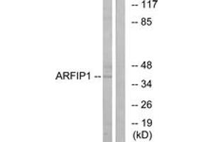 Western blot analysis of extracts from Jurkat cells, using ARFIP1 Antibody. (ARFIP1 antibody  (AA 271-320))