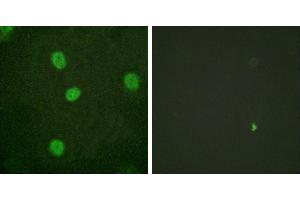 P-peptide - +Western blot analysis of extracts from K562 cells, using B-Myb (Phospho-Ser577/581) antibody.