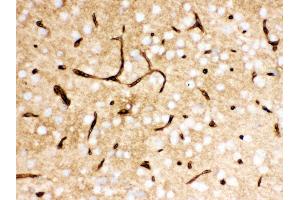 Anti- SLC2A1 Picoband antibody, IHC(P) IHC(P): Mouse Brain Tissue (GLUT1 antibody  (AA 92-492))
