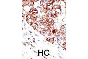Immunohistochemistry (Paraffin-embedded Sections) (IHC (p)) image for anti-Protein Inhibitor of Activated STAT, 1 (PIAS1) (AA 607-637), (C-Term) antibody (ABIN388055)