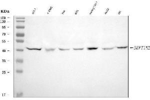 Western blot analysis of Septin 2/SEPTIN2 using anti-Septin 2/SEPTIN2 antibody (ABIN7599275).