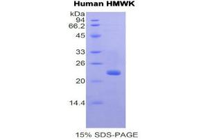 SDS-PAGE (SDS) image for Kininogen (High Molecular Weight) (AA 225-407) protein (His tag) (ABIN1877482) (Kininogen (HMW) Protein (AA 225-407) (His tag))