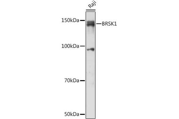 BRSK1 antibody  (AA 310-510)