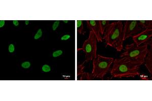 Immunofluorescence (IF) image for anti-RecQ Protein-Like (DNA Helicase Q1-Like) (RECQL) (N-Term) antibody (ABIN2857056)