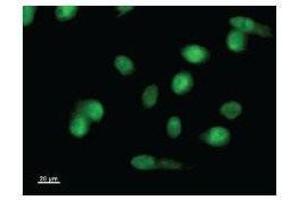 Immunostaining analysis in HeLa cells. (LMO1 antibody)