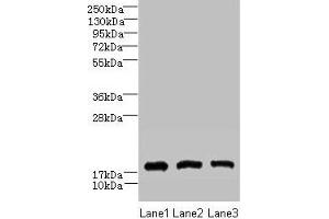Western blot All lanes: CNIH2 antibody at 2 μg/mL Lane 1: U251 whole cell lysate Lane 2: Mouse liver tissue Lane 3: Mouse kidney tissue Secondary Goat polyclonal to rabbit IgG at 1/10000 dilution Predicted band size: 19 kDa Observed band size: 19 kDa (CNIH2 antibody  (AA 94-138))