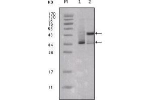 Western blot analysis using ESR1 mouse mAb against truncated ESR1-His recombinant protein (1) and truncated Trx-ESR1 recombinant protein (2). (Estrogen Receptor alpha antibody  (AA 301-595))