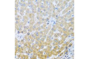 Immunohistochemistry of paraffin-embedded human liver using IL20 antibody at dilution of 1:100 (40x lens).