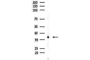 anti-TATA Box Binding Protein (TBP) (N-Term) antibody