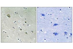 Immunohistochemistry (IHC) image for anti-P21-Activated Kinase 1 (PAK1) (pSer204) antibody (ABIN1847637) (PAK1 antibody  (pSer204))