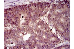 Immunohistochemistry (IHC) image for anti-Eukaryotic Translation Initiation Factor 4B (EIF4B) antibody (ABIN969517)