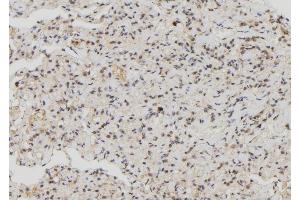 ABIN6276875 at 1/100 staining Human lung tissue by IHC-P. (MX1 antibody  (C-Term))
