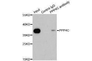 Immunoprecipitation analysis of 200ug extracts of 293T cells using 1ug PPP4C antibody.