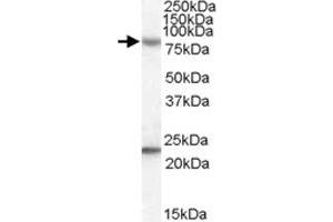 DHX58 polyclonal antibody  (0.