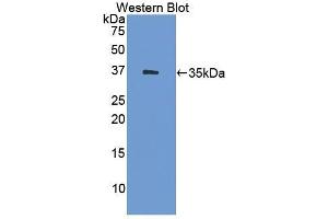 Detection of Recombinant HSD17b1, Human using Polyclonal Antibody to 17-Beta-Hydroxysteroid Dehydrogenase Type 1 (HSD17b1) (HSD17B1 antibody  (AA 4-289))