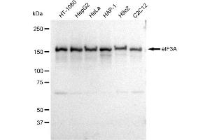 anti-Eukaryotic Translation Initiation Factor 3 Subunit A (EIF3A) antibody