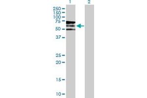 Western Blot analysis of PIP5K3 expression in transfected 293T cell line by PIP5K3 MaxPab polyclonal antibody. (PIKFYVE antibody  (AA 1-451))