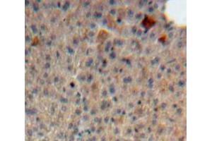 Used in DAB staining on fromalin fixed paraffin-embedded Liver tissue (Syndecan 1 antibody  (AA 23-255))