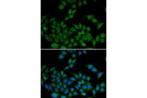 Immunofluorescence analysis of HeLa cells using DIDO1 antibody (ABIN5973852). (DIDO1 antibody)