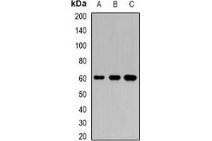 Western blot analysis of Karyopherin alpha-6 expression in BT474 (A), SW620 (B), mouse testis (C) whole cell lysates.