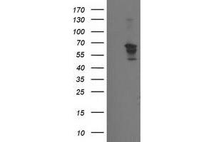 HEK293T cells were transfected with the pCMV6-ENTRY control (Left lane) or pCMV6-ENTRY BECN1 (Right lane) cDNA for 48 hrs and lysed. (Beclin 1 antibody)