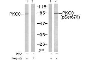 Image no. 2 for anti-Protein Kinase C, theta (PRKCQ) (pSer676) antibody (ABIN197070)