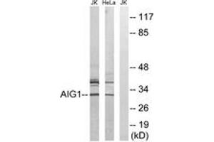 Western blot analysis of extracts from HeLa/Jurkat cells, using AIG1 Antibody. (AIG1 antibody  (AA 196-245))