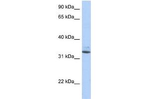 WB Suggested Anti-SULT1A1 Antibody Titration:  0. (SULT1A1 antibody  (N-Term))