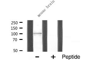 Western blot analysis of HXK1 expression in Mouse brain lysate (Hexokinase 1 antibody  (N-Term))